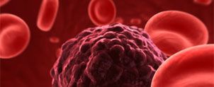 Your Cancer Was Not Diagnosed Properly By the Doctors You Trusted. Is It Time To Speak With an Atlanta Cancer Lawyer